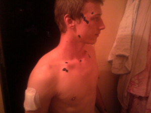 Napadený přítel těhotné ženy. Foto archiv rodiny