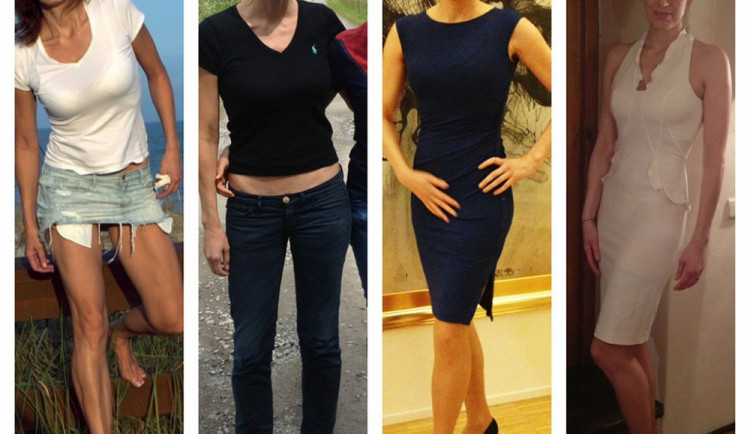 Paní Petra před, v průběhu a po onemocnění rakovinou prsu. Snímky byly pořízeny v rozmezí osmi měsíců