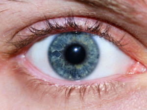 Sluneční záření není radno podceňovat. Může způsobit nádor nitra oka