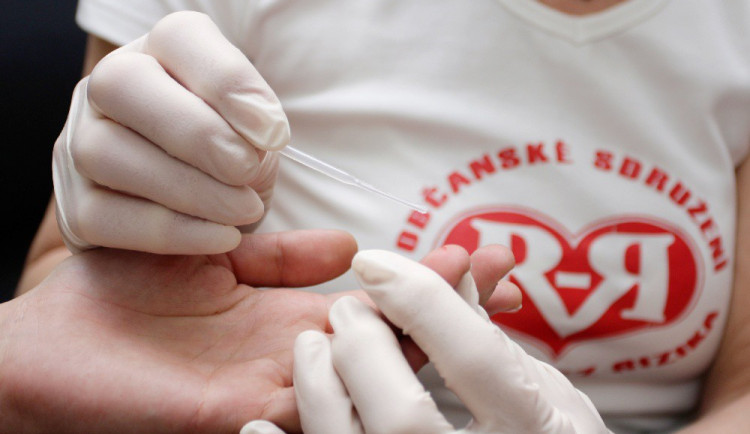 Další bezplatné testování veřejnosti na onemocnění virem HIV proběhne v úterý