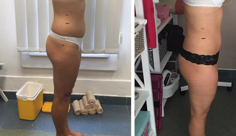 Body Wraps vám zdravě a rychle pomůže od přebytečného tuku a celulitidy
