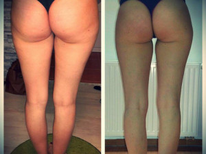 Body Wraps