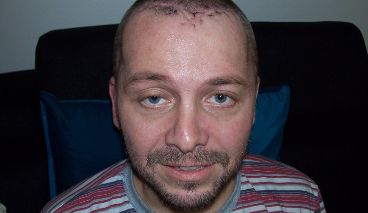 Antonín Vítek po druhé operaci