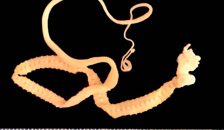 Diphyllobothrium latum