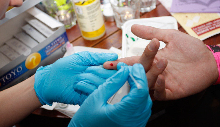 HIV je stále na vzestupu. V Budějcích se bude na konci listopadu testovat bezplatně