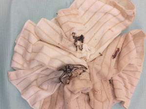 Na místě našla policie několik utěrek, které mohou s případem souviset.