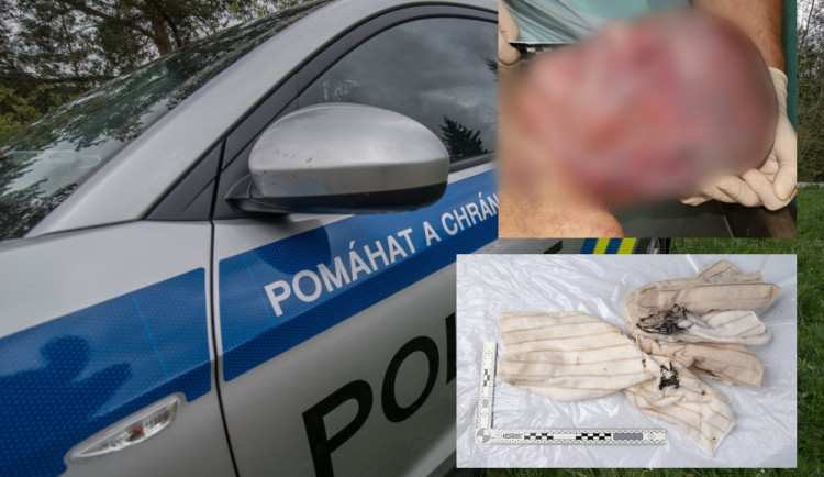 Policie stále nezná totožnost muže zavražděného u Schwarzenberského kanálu.