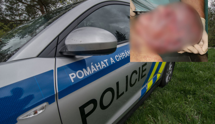 Policie zná totožnost muže zavražděného u Nové Pece. K identifikaci pomohl kyčelní implantát