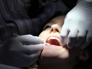 Častý problém zubních ordinací – zahraniční lékaři bez kompletního pracovního povolení
