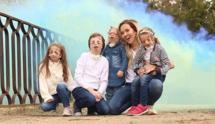 Tamara Klusová společně s dětmi s Treacher Collins syndromem. Uprostřed je také malá Beátka Hladová.