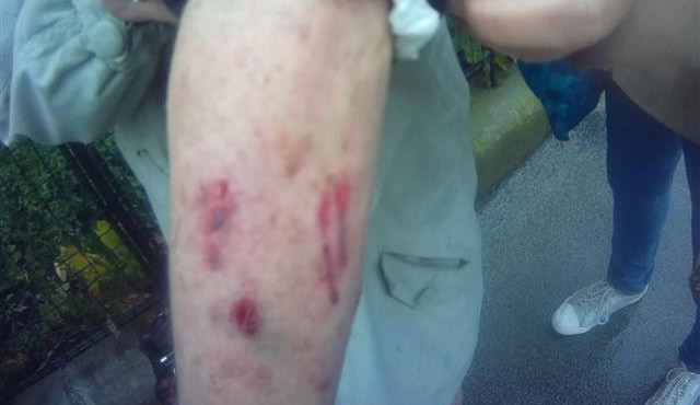 Seniorku v Brně v sobotu pokousal pes. Byl na vodítku, náhubek ale neměl