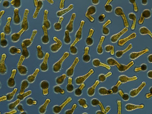 Mikroskopický snímek lahvenky velké. Jak název napovídá, buňky mají lahvovitý tvar o délce 200–300 mikrometrů