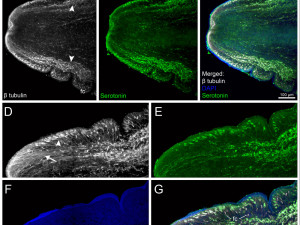 Hlava skulovce sirokeho_snimek z konfokalniho mikroskopu