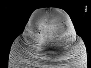 Hlava skulovce sirokeho_snimek z elektronoveho mikroskopu