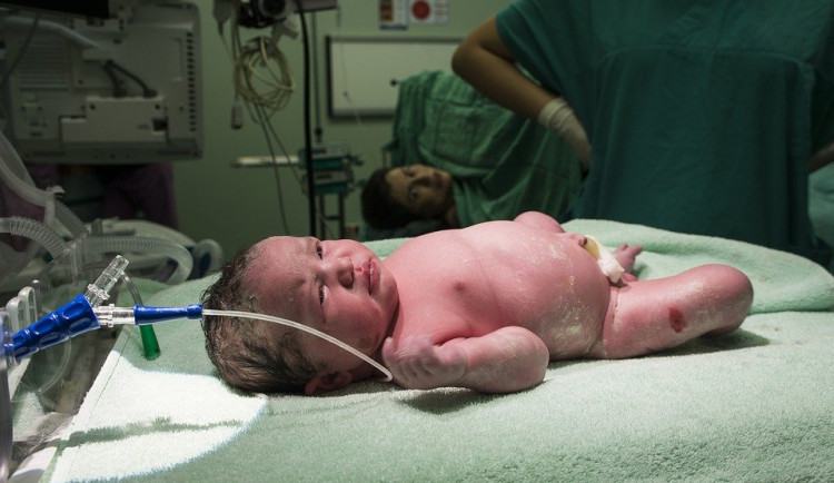 Tatínci mohou znovu k porodu. Ministerstvo zdravotnictví zrušilo nařízení z poloviny března
