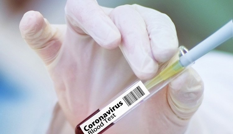 Na Táborsku se objevily dva nové případy onemocnění koronavirem, od zítra se mění režim pro pendlery