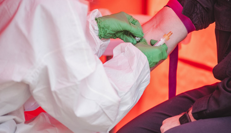 V Českém Krumlově se zájemci budou moci nechat otestovat na protilátky proti koronaviru