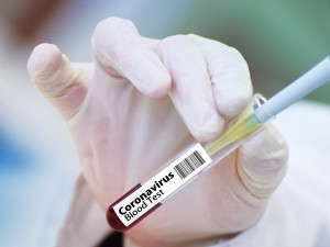 Na jihu Čech jsou čtyři okresy bez pozitivních případů. Aktuálně je nakažených 12 Jihočechů
