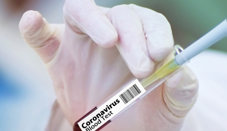 Všechny testy na koronavirus ve Vodňanské drůbeži jsou negativní