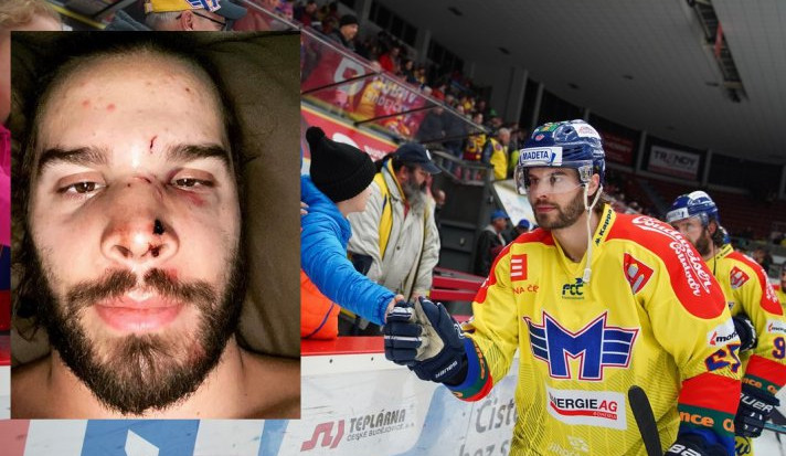 David Gilbert je po operaci. Ošklivé zranění si hokejista způsobil při tréninku.