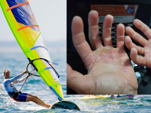 Jak bolí olympiáda? Takhle vypadaly ruce českého windsufera na konci dne