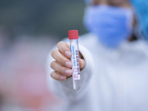 Jihočeské nemocnice trojnásobně navýší kapacitu testů na koronavirus