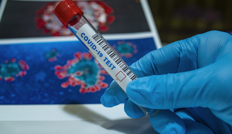 Jihočeští hygienici za týden evidovali přes čtyři tisíce případů covidu, méně než před týdnem