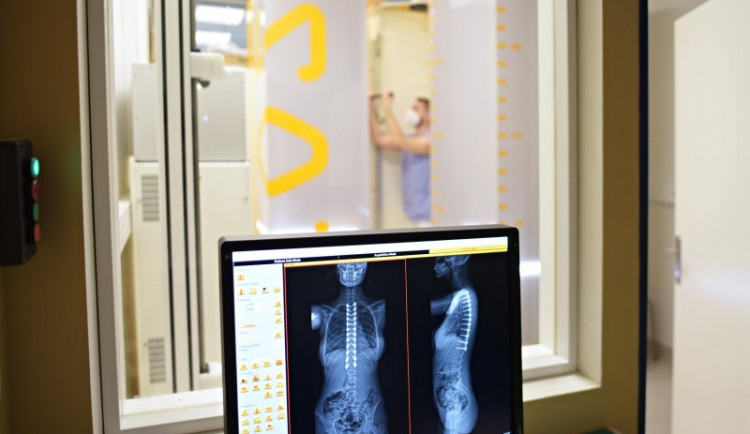 Brněnští lékaři mají jako první v Česku 3D rentgen s nízkou dávkou záření