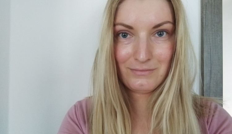 Atopický ekzém se mi objevuje téměř po celém těle. Nejhorší je stres, říká Veronika Seberová