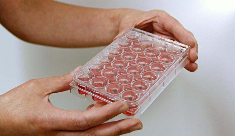 Parazit se pro laboratořní účely chová v živném médiu.