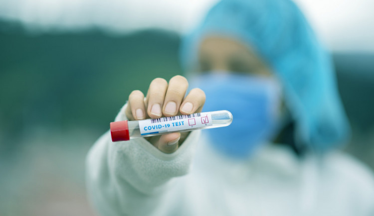 Hygienici na jihu Čech evidují od začátku týdne 153 nových případů covidu