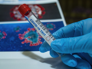 Jihočeští hygienici evidovali za sedm dní 93 případů covidu na 100 tisíc lidí