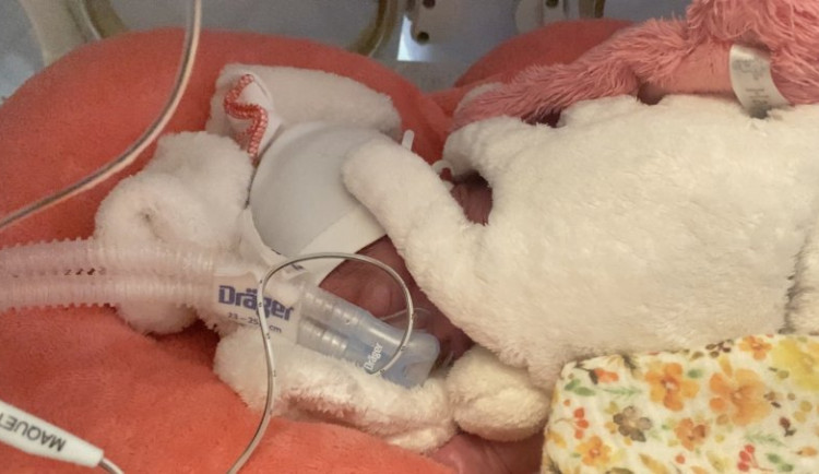 V Brně pomáhá novorozencům s dýcháním unikátní přístroj