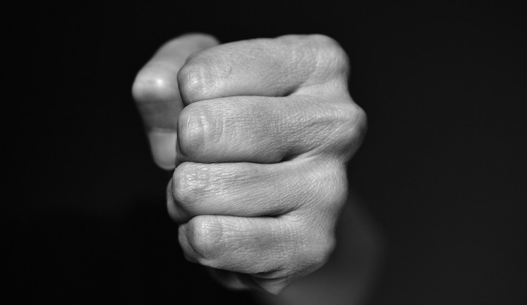 Brutální napadení v Havlíčkově Brodě: Muže čeká operace a dlouhé léčení. Byli to cikáni, říká jeho manželka