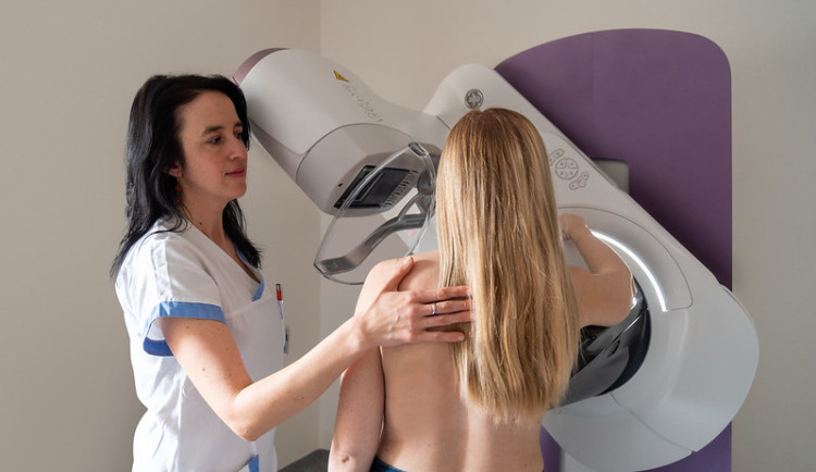 Fakultní nemocnice pořídila špičkový mamograf, který disponuje umělou inteligencí