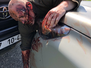 Vojákyně zvládnou namaskovat nejrůznější druhy poranění, jako jsou zlomeniny, popáleniny, poranění břicha či tepenná krvácení.