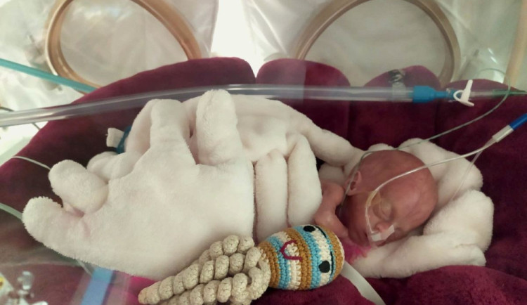 VIDEO: Olomoucká Fakultní nemocnice ukázala, jak náročná a unikátní je péče o miminka do dlaně