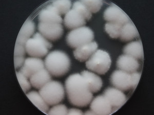 Entomopatogenní houba Cordyceps na laboratorní misce.j pg