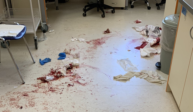 Trestní stíhání muže, který útočil v nemocnici mačetou, bylo zastaveno. Během útoku nebyl příčetný