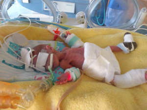 Když se narodili, vážili dohromady necelých 1200 gramů. Do života to Matějovi a Šimonovi přineslo řadu zdravotních problémů