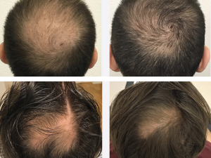 Před ošetřením a po ošetření.