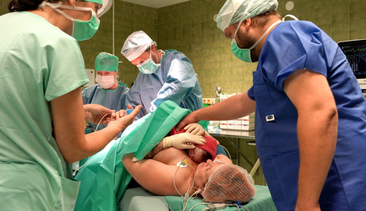 Novorozence si maminka vytáhla sama. Denisa v šumperské porodnici prožila laskavý císařský řez