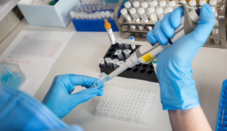 FN Ostrava by letos mohla začít budovat Moravskoslezské onkologické centrum