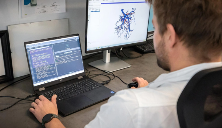 V Ostravě jako jedni z prvních využívají umělou inteligenci k předoperační 3D vizualizaci cév