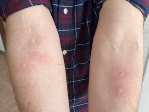 Na jarní alergie platí procházky po dešti, odborníci radí i další fígle