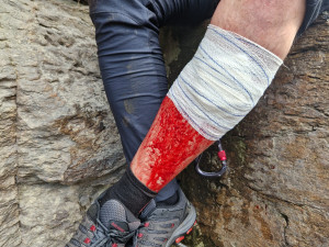 Po chvilce nepozornosti přišel bolestivý pád. Hasiči opět zasahovali na bechyňské ferratě