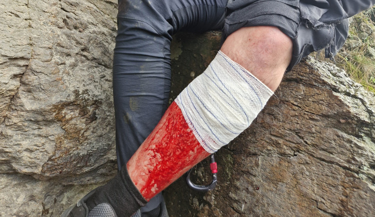 Po chvilce nepozornosti přišel bolestivý pád. Hasiči opět zasahovali na bechyňské ferratě