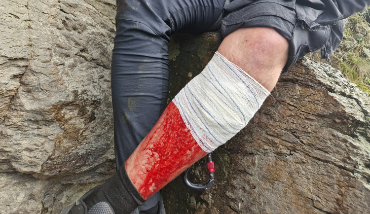 Po chvilce nepozornosti přišel bolestivý pád. Hasiči opět zasahovali na bechyňské ferratě