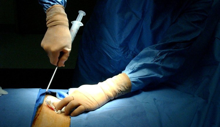 Záchranáři hledají dárce pro mladého hasiče. Bojuje s agresivní leukémií