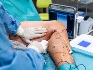 Písečtí chirurgové používají na křečové žíly laser.